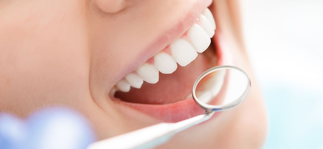 予防歯科で行なう処置